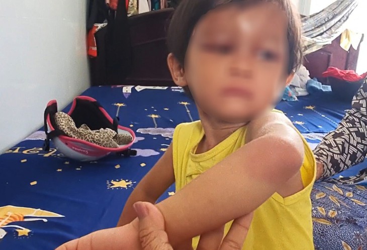 Bắt tạm giam cha nuôi hành hạ bé gái 4 tuổi ở Cà Mau- Ảnh 1.