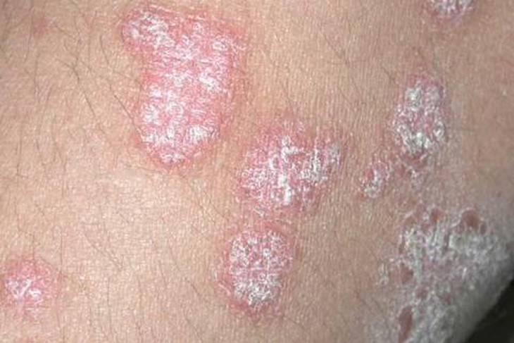 photo-1699972384814
