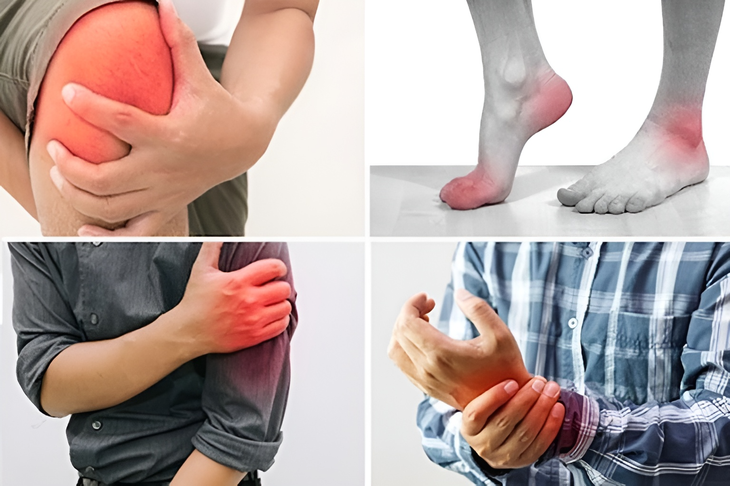 Làm gì để cải thiện đau mỏi cơ xương khớp khi thay đổi thời tiết- Ảnh 1.