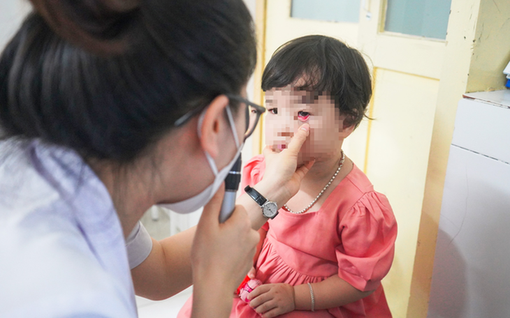 Lai Châu: Tăng cường giám sát chặt chẽ để hạn chế bệnh đau mắt đỏ lây lan- Ảnh 1.