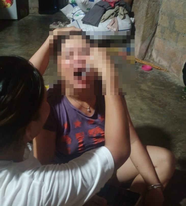 Nữ đồng đẳng viên băng rừng giúp đỡ những người nhiễm HIV- Ảnh 1. Nữ đồng đẳng viên băng rừng giúp đỡ những người nhiễm HIV- Ảnh 1.