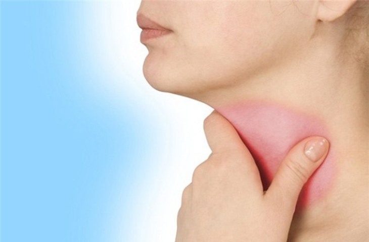 Bệnh viêm họng là tình trạng mà cổ họng và hầu bị viêm do vi khuẩn hoặc virus gây ra, khiến cho cổ họng đau rát, khó chịu.