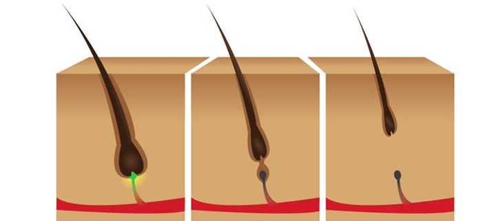 Khắc phục tình trạng rụng tóc theo mùa bằng giải pháp tự nhiên- Ảnh 2.