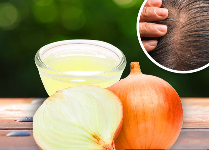 Khắc phục tình trạng rụng tóc theo mùa bằng giải pháp tự nhiên- Ảnh 4.