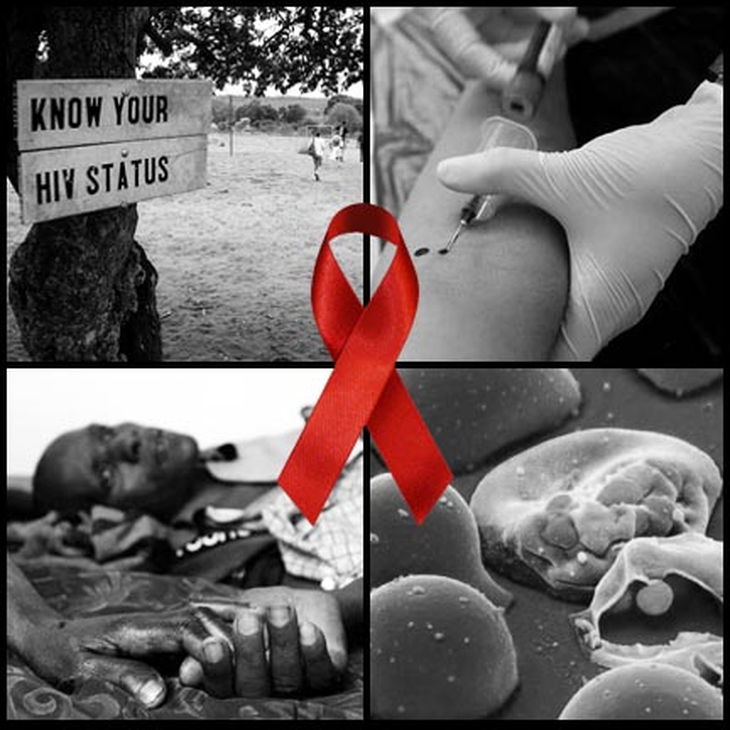 Nguy cơ nhiễm HIV khi xăm thẩm mỹ không an toàn- Ảnh 2. Nguy cơ nhiễm HIV khi xăm thẩm mỹ không an toàn- Ảnh 2.