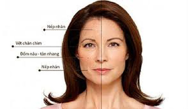 Thức khuya ảnh hưởng đến làn da thế nào?- Ảnh 1. Thức khuya ảnh hưởng đến làn da thế nào?- Ảnh 1.