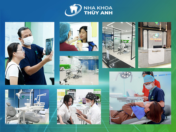 7 tiêu chuẩn "vàng" cho nụ cười đẹp sau bọc sứ- Ảnh 3.