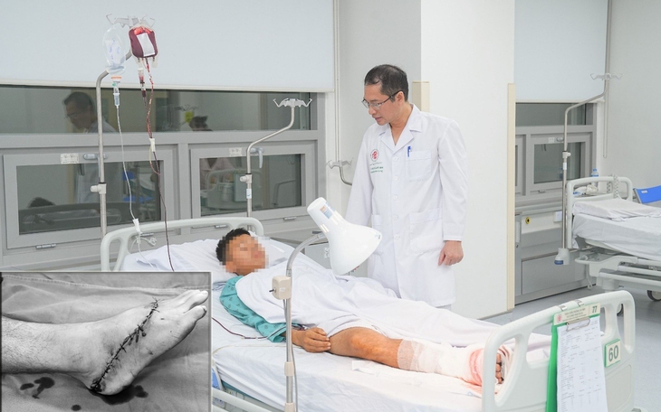 Liên tiếp xảy ra tai nạn kinh hoàng từ máy cắt cỏ