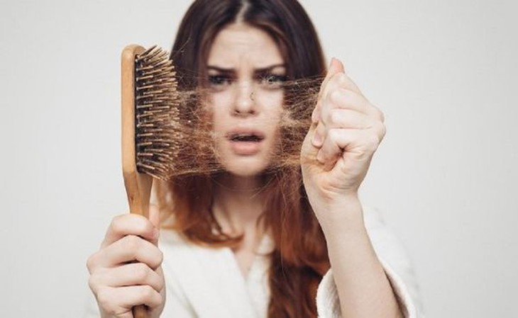 Cấy tóc tự thân có tốt không?- Ảnh 3.