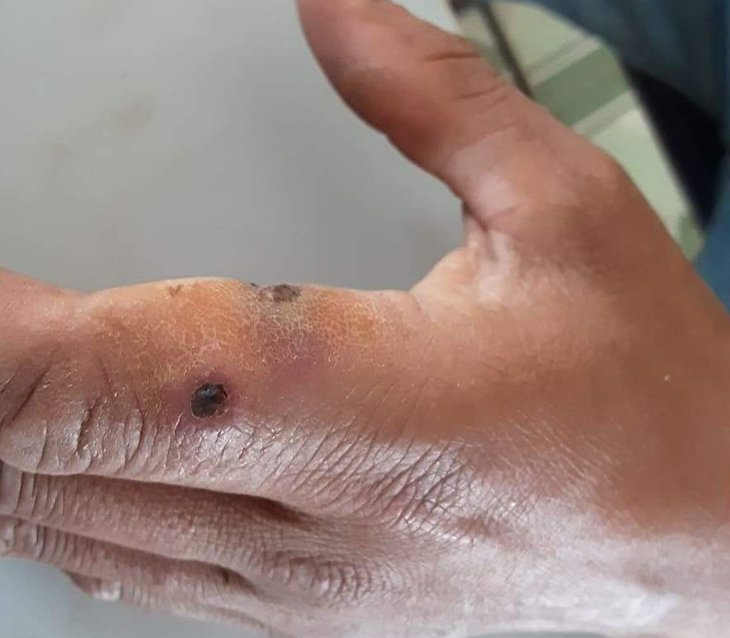 Lai Châu: Khẩn trương kiểm soát, không để dịch bệnh than lây lan trên diện rộng- Ảnh 1.