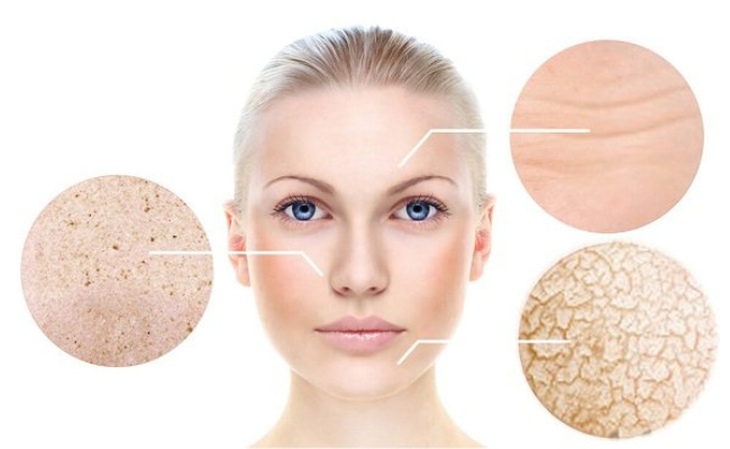 8 bước làm mềm da khô đơn giản khi thời tiết lạnh- Ảnh 1.