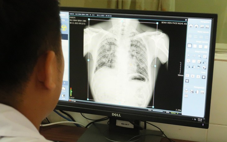 Thêm một công nhân ở Nghệ An tử vong do bụi phổi