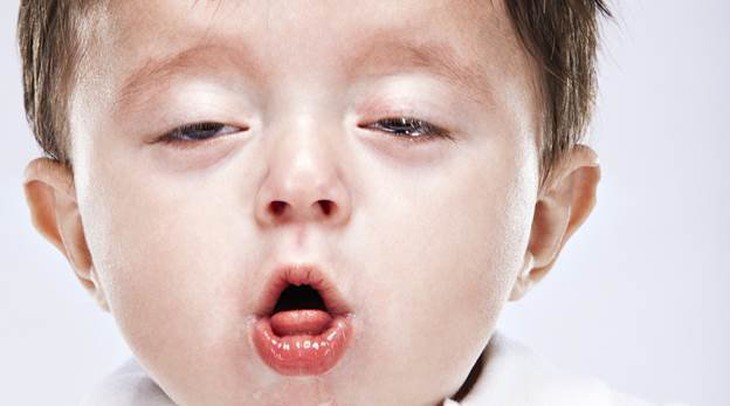 Cách phân biệt trẻ ho gà với ho thông thường- Ảnh 1.