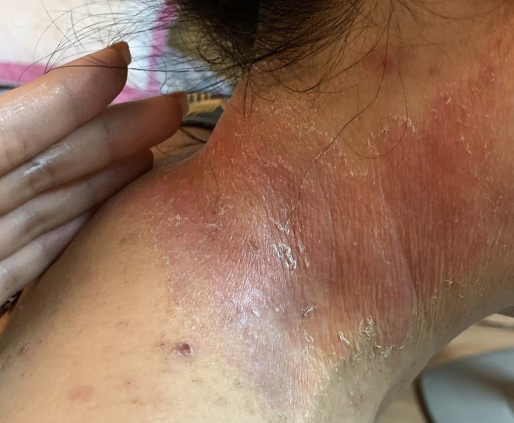 Người dân Hà Nội kêu trời bởi nạn kiến ba khoang hoành hành - Ảnh 2.