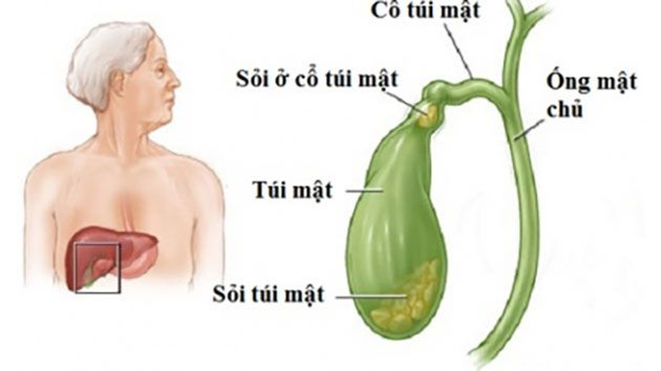 Một vài lầm tưởng khi uống tinh bột nghệ - Ảnh 3.