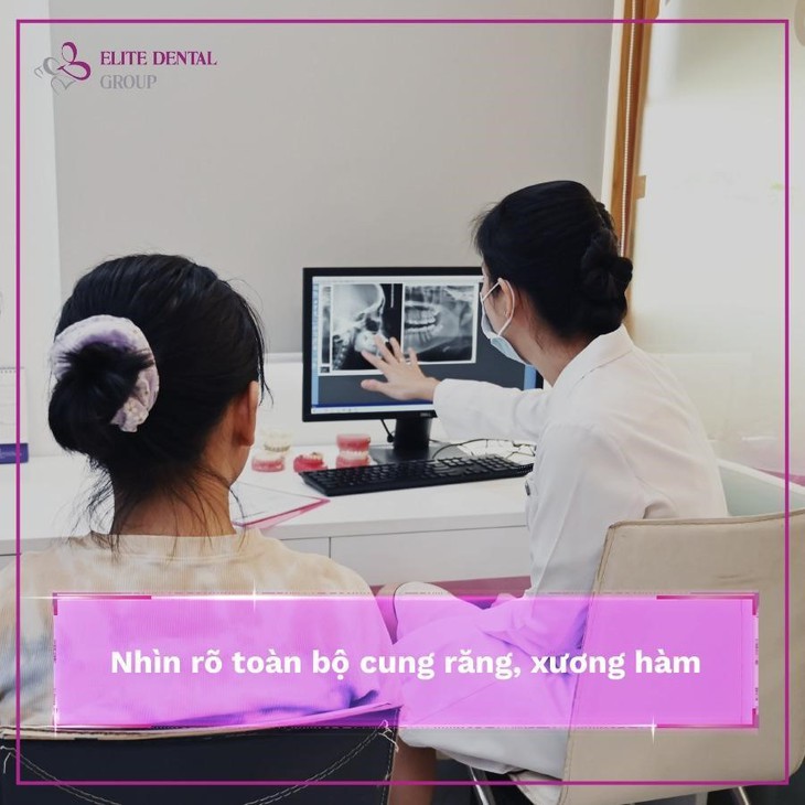 Nguy cơ niềng răng bị hỏng: Cảnh báo đáng lưu ý - Ảnh 1. Nguy cơ niềng răng bị hỏng: Cảnh báo đáng lưu ý - Ảnh 1.