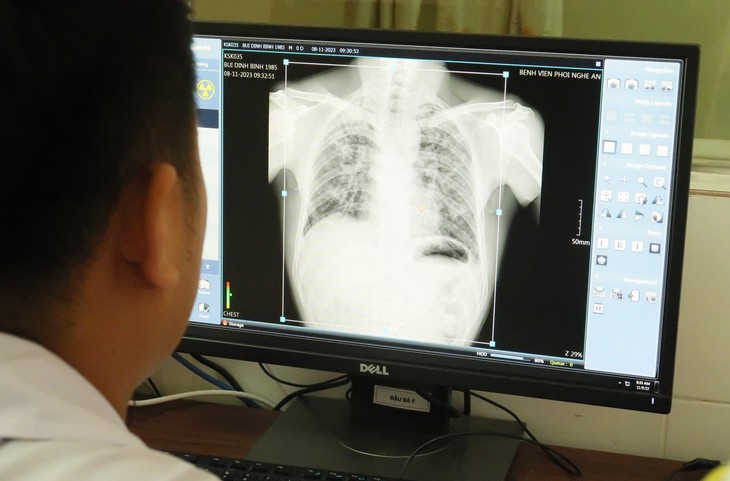 Vụ 5 công nhân tử vong do bụi phổi: Khám phát hiện bệnh nghề nghiệp cho công nhân - Ảnh 5. Vụ 5 công nhân tử vong do bụi phổi: Khám phát hiện bệnh nghề nghiệp cho công nhân - Ảnh 5.