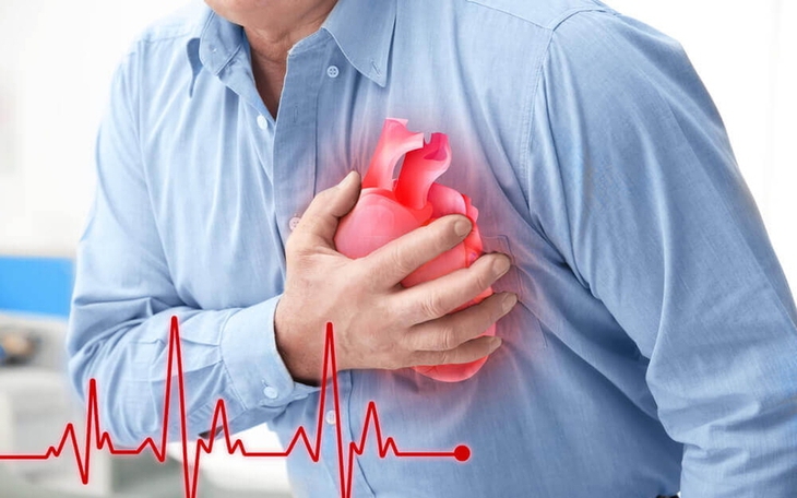 Đau tức ngực có phải dấu hiệu cảnh báo bệnh động mạch vành?