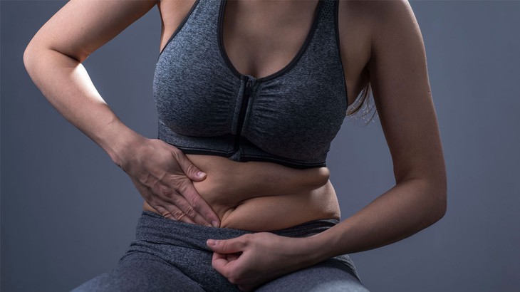 Cách nào khắc phục da chảy xệ sau giảm cân?- Ảnh 1. Cách nào khắc phục da chảy xệ sau giảm cân?- Ảnh 1.