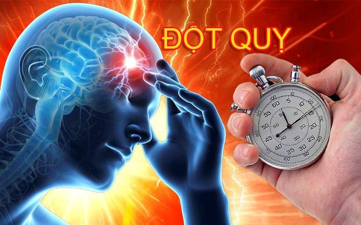 Cảnh báo xuất huyết não sau những cuộc nhậu kéo dài- Ảnh 1.