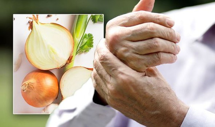 Ăn hành tây mỗi ngày ngừa loãng xương, viêm khớp và nhiều lợi ích khác- Ảnh 2. Ăn hành tây mỗi ngày ngừa loãng xương, viêm khớp và nhiều lợi ích khác- Ảnh 2.