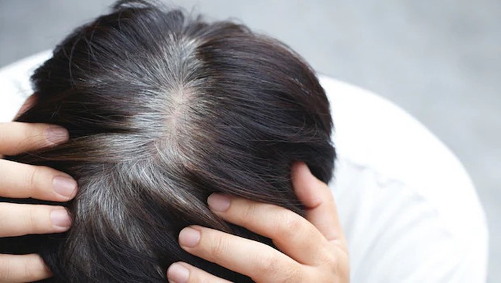 5 nguyên liệu tự nhiên giúp cải thiện tóc bạc sớm- Ảnh 1.