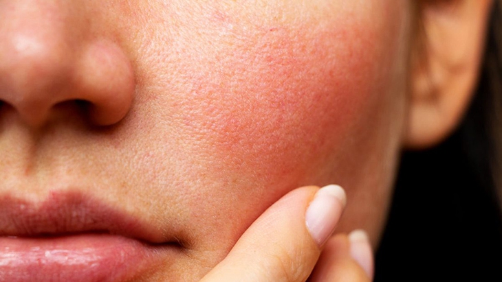 Nếu cơ thể luôn đủ nước, làn da sẽ đảm bảo tính đàn hồi tự nhiên vốn có. Ảnh minh họa