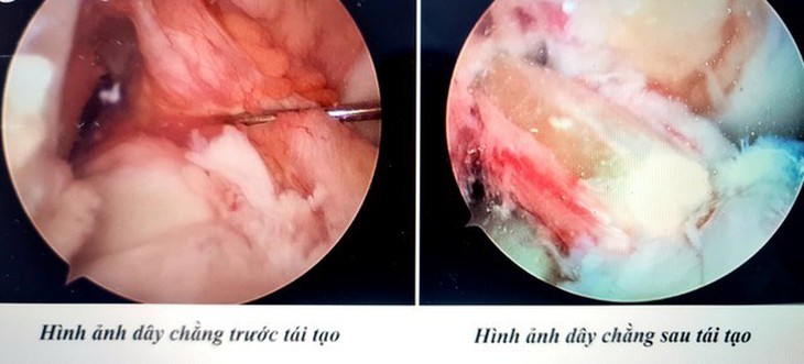 Bệnh viện Chấn thương - Chỉnh hình Nghệ An: Điều trị thành công trên 400 ca chấn thương thể thao mỗi năm- Ảnh 1. Bệnh viện Chấn thương - Chỉnh hình Nghệ An: Điều trị thành công trên 400 ca chấn thương thể thao mỗi năm- Ảnh 1.