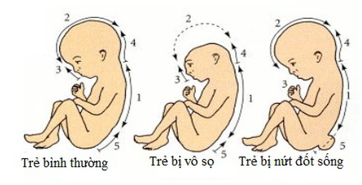10 thực phẩm giàu acid folic giúp phòng ngừa dị tật bẩm sinh ở thai nhi- Ảnh 1. 10 thực phẩm giàu acid folic giúp phòng ngừa dị tật bẩm sinh ở thai nhi- Ảnh 1.