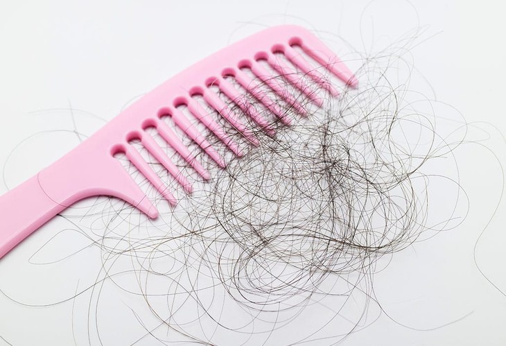 Cách khắc phục rụng tóc do giảm cân- Ảnh 1.