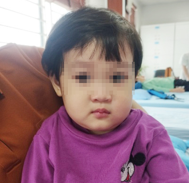 Bé 24 tháng tuổi liệt dây thần kinh số VII khi thời tiết giao mùa- Ảnh 3. Bé 24 tháng tuổi liệt dây thần kinh số VII khi thời tiết giao mùa- Ảnh 3.
