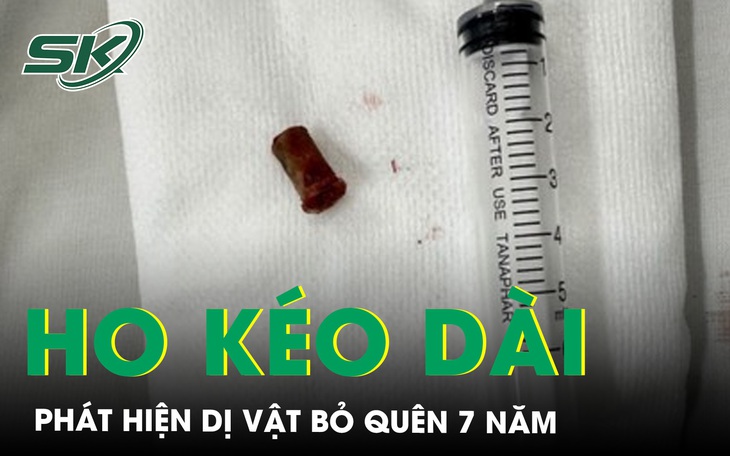 Ho kéo dài, bàng hoàng phát hiện dị vật 7 năm bỏ quên