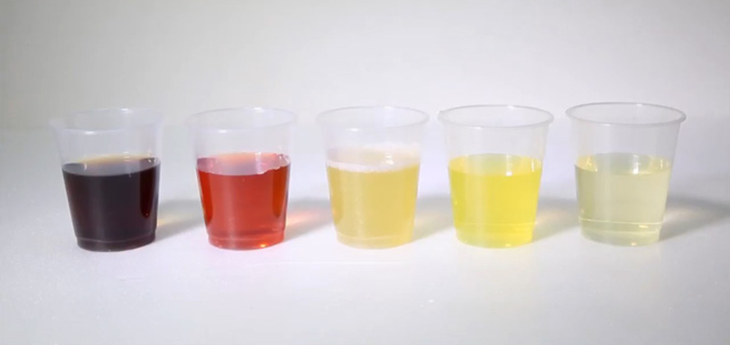 Màu sắc của nước tiểu cũng có thể nói lên chính xác tình trạng sức khỏe của bạn. Ảnh minh họa