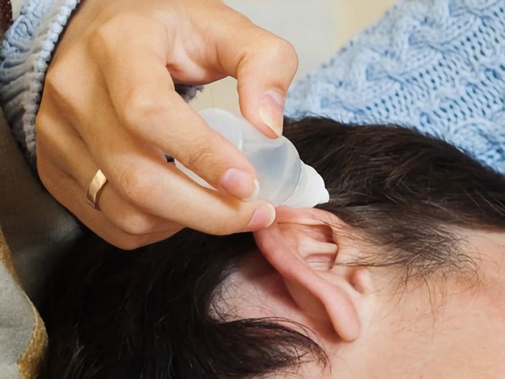 Bị điếc do dùng thuốc nhỏ tai polydexa sai cách- Ảnh 1. Bị điếc do dùng thuốc nhỏ tai polydexa sai cách- Ảnh 1.