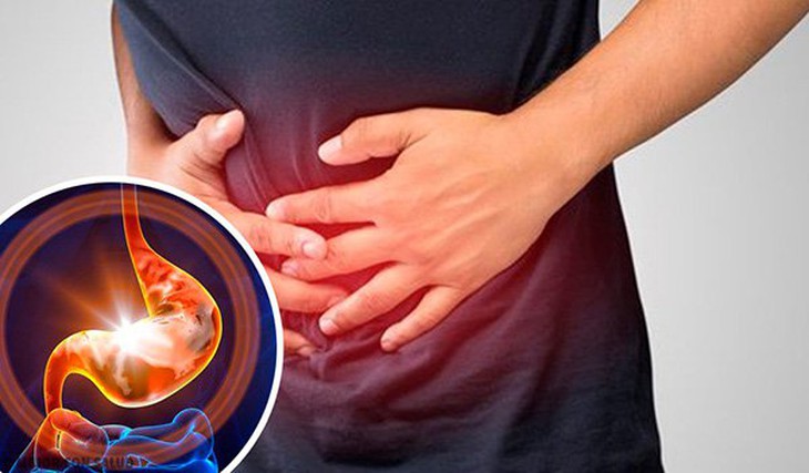 Cách ăn ngon mà không lo rối loạn tiêu hóa trong những ngày nghỉ lễ- Ảnh 1. Cách ăn ngon mà không lo rối loạn tiêu hóa trong những ngày nghỉ lễ- Ảnh 1.