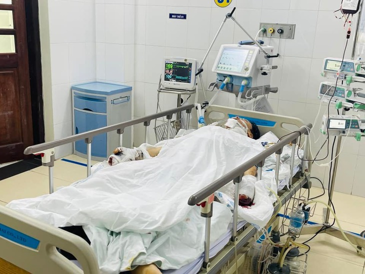 Học chế pháo trên mạng, một học sinh bị đa chấn thương nguy kịch- Ảnh 2. Học chế pháo trên mạng, một học sinh bị đa chấn thương nguy kịch- Ảnh 2.