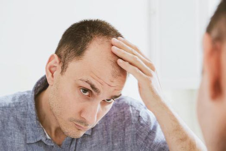 Thủ dâm có gây rụng tóc không?- Ảnh 2. Thủ dâm có gây rụng tóc không?- Ảnh 2.