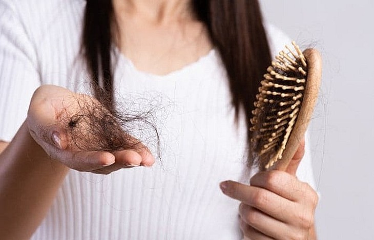 Rụng tóc do thiếu chất gì?- Ảnh 1. Rụng tóc do thiếu chất gì?- Ảnh 1.