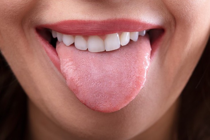 Tê lưỡi có thể là dấu hiệu của nhiều bệnh nguy hiểm - Ảnh 2.