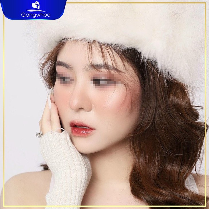 Top 6 dáng mũi đẹp trở thành "hot trend" trong năm 2023 Quý Mão - Ảnh 1. Top 6 dáng mũi đẹp trở thành "hot trend" trong năm 2023 Quý Mão - Ảnh 1.