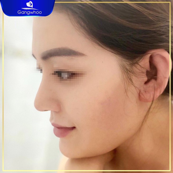 Top 6 dáng mũi đẹp trở thành "hot trend" trong năm 2023 Quý Mão - Ảnh 2. Top 6 dáng mũi đẹp trở thành "hot trend" trong năm 2023 Quý Mão - Ảnh 2.