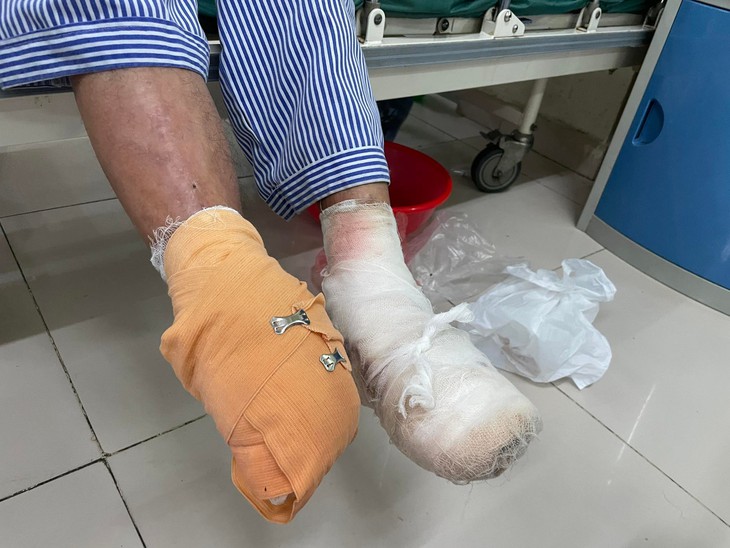 Nhiều người phải cắt ngón chân, bàn chân... do biến chứng đái tháo đường: Bác sĩ khuyến cáo gì?
- Ảnh 1. Nhiều người phải cắt ngón chân, bàn chân... do biến chứng đái tháo đường: Bác sĩ khuyến cáo gì?
- Ảnh 1.