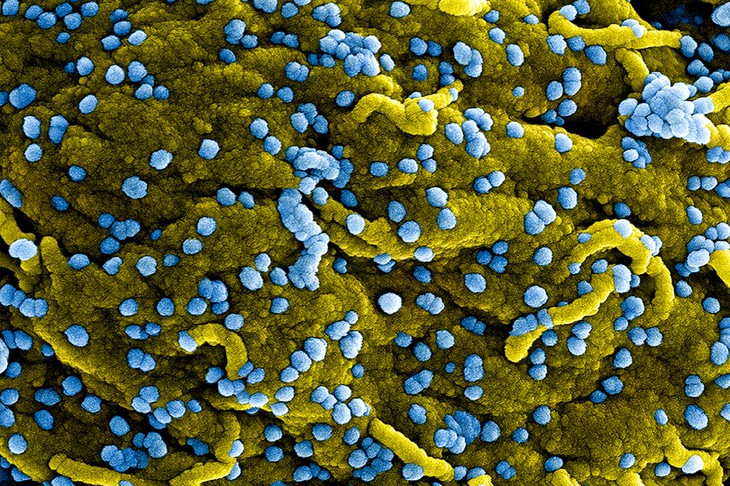 WHO hy vọng sớm thử nghiệm vaccine ngừa virus Marburg trước ổ dịch ở Guinea Xích đạo - Ảnh 2. WHO hy vọng sớm thử nghiệm vaccine ngừa virus Marburg trước ổ dịch ở Guinea Xích đạo - Ảnh 2.