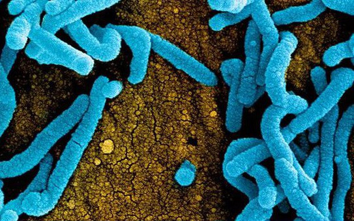 Bệnh do virus Marburg có tỉ lệ tử vong cao nhưng không dễ lây, chuyên gia lý giải