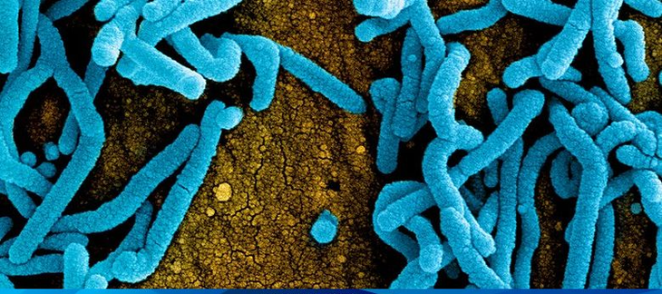 Bệnh do virus Marburg có tỉ lệ tử vong cao nhưng không dễ lây, chuyên gia lý giải - Ảnh 2. Bệnh do virus Marburg có tỉ lệ tử vong cao nhưng không dễ lây, chuyên gia lý giải - Ảnh 2.