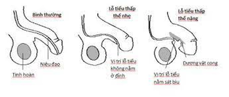 Xác định được nguyên nhân gây dị tật bẩm sinh ảnh hưởng tới khả năng sinh sản của nam giới - Ảnh 2.