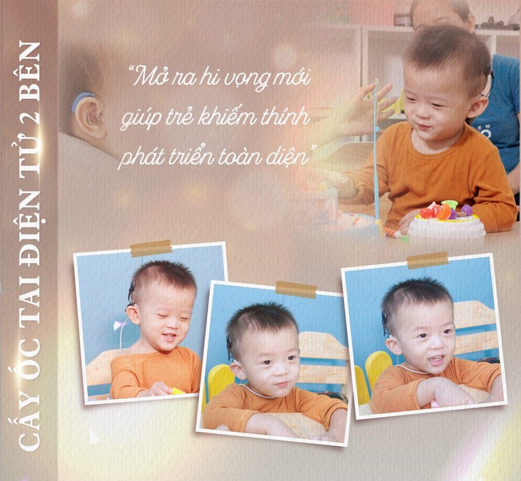 Cấy ốc tai điện tử cho bé viêm màng não – Hành trình cảm động tìm lại thanh âm cho con - Ảnh 4. Cấy ốc tai điện tử cho bé viêm màng não – Hành trình cảm động tìm lại thanh âm cho con - Ảnh 4.