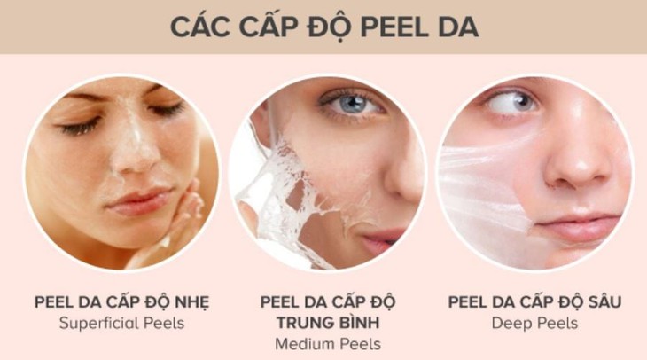Peel da đơn giản nhưng chớ nên thực hiện khi không biết cách - Ảnh 1.