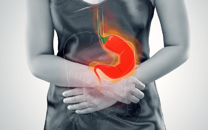 8 cách giúp giảm ợ nóng, ợ chua do trào ngược dạ dày khi mang thai