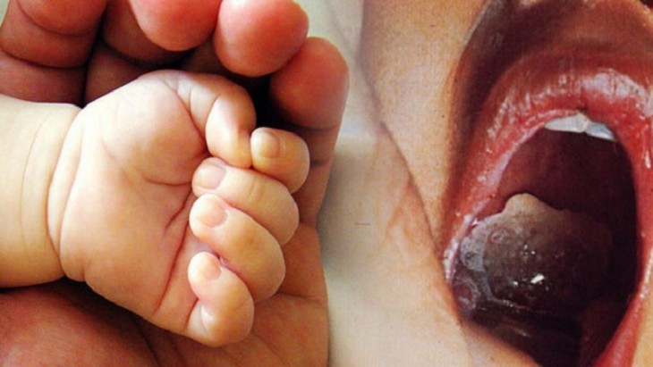 Bạch hầu có nguy hiểm? Làm thế nào để phòng bệnh? - Ảnh 2.